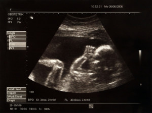 Bild eines Ungeborenen im Mutterleib